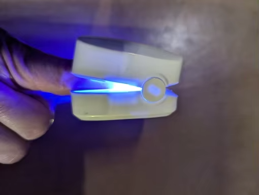 Nagelsvamp laser photo review