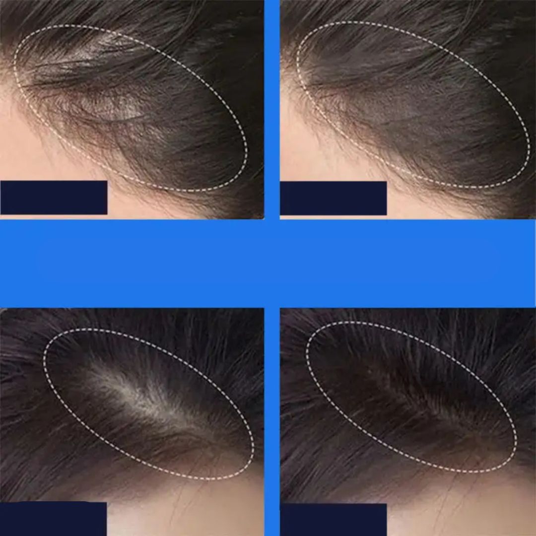 Hair concealer